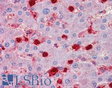 S100A9 / MRP14 Antibody - Anti-S100A9 / MRP14 antibody IHC of human liver. Immunohistochemistry of formalin-fixed, paraffin-embedded tissue after heat-induced antigen retrieval. Antibody concentration 2.5 ug/ml.
