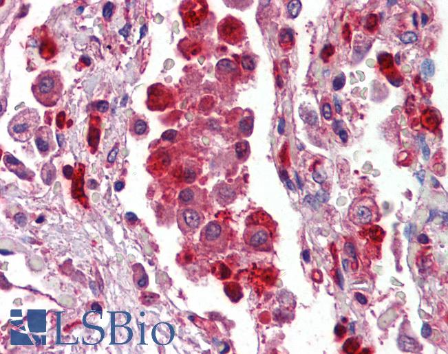 S100A9 / MRP14 Antibody - Anti-S100A9 / MRP14 antibody IHC of human lung. Immunohistochemistry of formalin-fixed, paraffin-embedded tissue after heat-induced antigen retrieval. Antibody concentration 2.5 ug/ml.