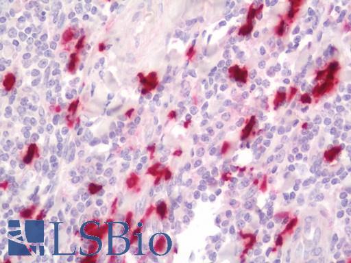 S100A9 / MRP14 Antibody - Human Tonsil: Formalin-Fixed, Paraffin-Embedded (FFPE).  This image was taken for the unconjugated form of this product. Other forms have not been tested.