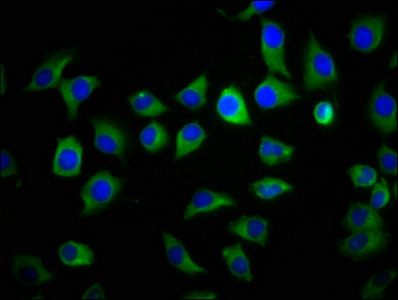 S100A9 / MRP14 Antibody - Immunofluorescence staining of A549 cells with S100A9 Antibody at 1:133, counter-stained with DAPI. The cells were fixed in 4% formaldehyde, permeabilized using 0.2% Triton X-100 and blocked in 10% normal Goat Serum. The cells were then incubated with the antibody overnight at 4°C. The secondary antibody was Alexa Fluor 488-congugated AffiniPure Goat Anti-Rabbit IgG(H+L).