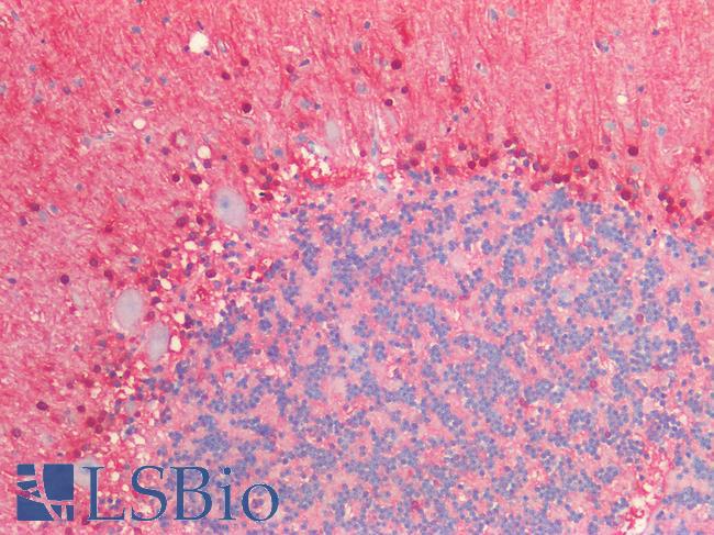 S100B / S100 Beta Antibody - Human Brain, Cerebellum: Formalin-Fixed, Paraffin-Embedded (FFPE)