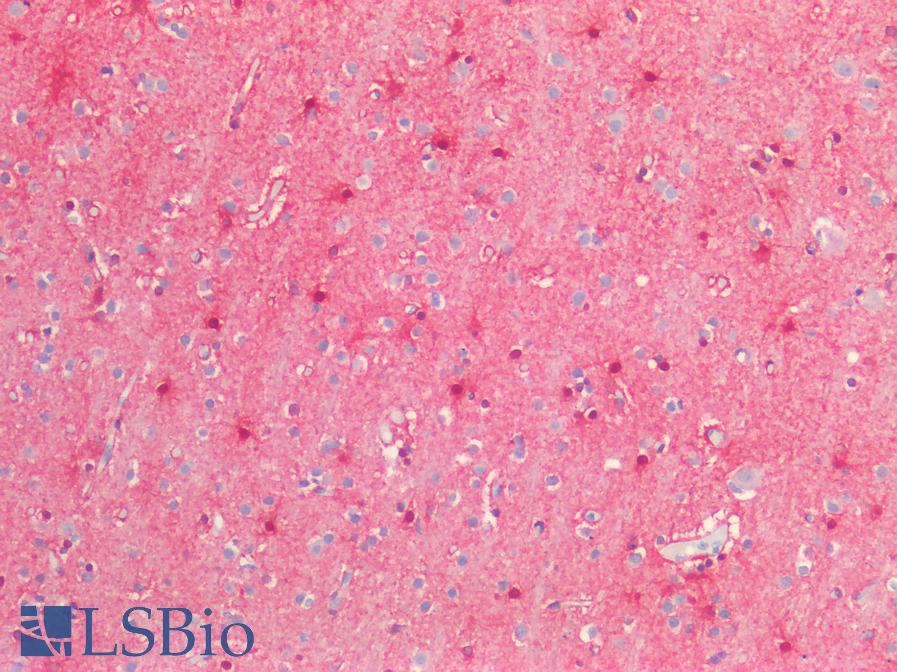 S100B / S100 Beta Antibody - Human Brain, Cortex: Formalin-Fixed, Paraffin-Embedded (FFPE)