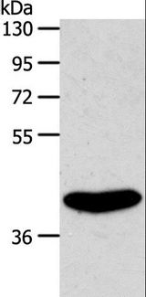 S1PR4 / SIP4 / EDG6 Antibody - Western blot analysis of Rat kidney tissue, using S1PR4 Polyclonal Antibody at dilution of 1:800.