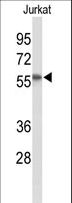 SACM1L / SAC1 Antibody - Western blot of SACM1L Antibody in Jurkat cell line lysates (35 ug/lane). SACM1L (arrow) was detected using the purified antibody.