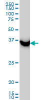 SAE1 Antibody - Western blot of SAE1 expression in HeLa.