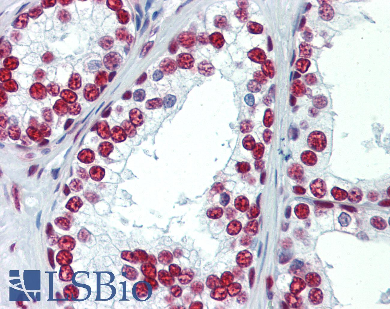 SAE1 Antibody - Anti-SAE1 antibody IHC staining of human prostate. Immunohistochemistry of formalin-fixed, paraffin-embedded tissue after heat-induced antigen retrieval.