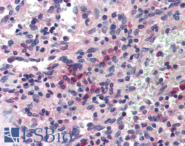 SAE1 Antibody - Anti-SAE1 antibody IHC of human spleen. Immunohistochemistry of formalin-fixed, paraffin-embedded tissue after heat-induced antigen retrieval. Antibody concentration 5 ug/ml.