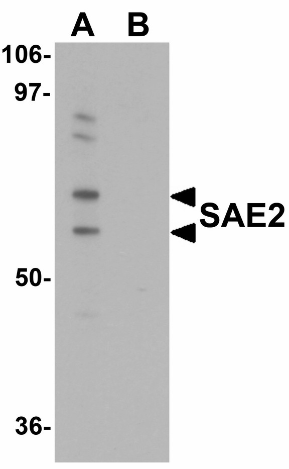 SAE2 / UBA2 Antibody - Western blot of SAE2 in 293 cell lysate with SAE2 antibody at 0.25 ug/ml in (A) the absence and (B) the presence of blocking peptide.