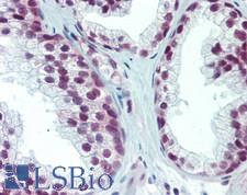 SAFB1 / SAFB Antibody - Human Prostate: Formalin-Fixed, Paraffin-Embedded (FFPE)