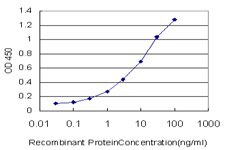 SAFB1 / SAFB Antibody - Detection limit for recombinant GST tagged SAFB is approximately 0.1 ng/ml as a capture antibody.