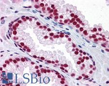 SAFB1 / SAFB Antibody - Anti-SAFB antibody IHC of human prostate. Immunohistochemistry of formalin-fixed, paraffin-embedded tissue after heat-induced antigen retrieval. Antibody concentration 5 ug/ml.