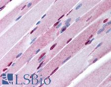 SALL4 Antibody - Anti-SALL4 antibody IHC of human skeletal muscle. Immunohistochemistry of formalin-fixed, paraffin-embedded tissue after heat-induced antigen retrieval. Antibody concentration 10 ug/ml.