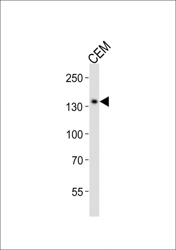 SALL4 Antibody - Western blot of lysate from CEM cell line, using SALL4 antibody diluted at 1:1000. A goat anti-rabbit IgG H&L (HRP) at 1:10000 dilution was used as the secondary antibody. Lysate at 20 ug.