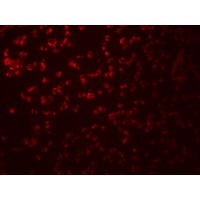 SAMHD1 Antibody - Immunofluorescence of SAMHD1 in Daudi cells with SAMHD1 antibody at 20 µg/ml.