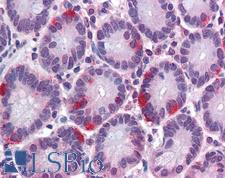 SAR1A / SAR1 Antibody - Anti-SAR1A antibody IHC of human small intestine. Immunohistochemistry of formalin-fixed, paraffin-embedded tissue after heat-induced antigen retrieval. Antibody concentration 3.75 ug/ml.