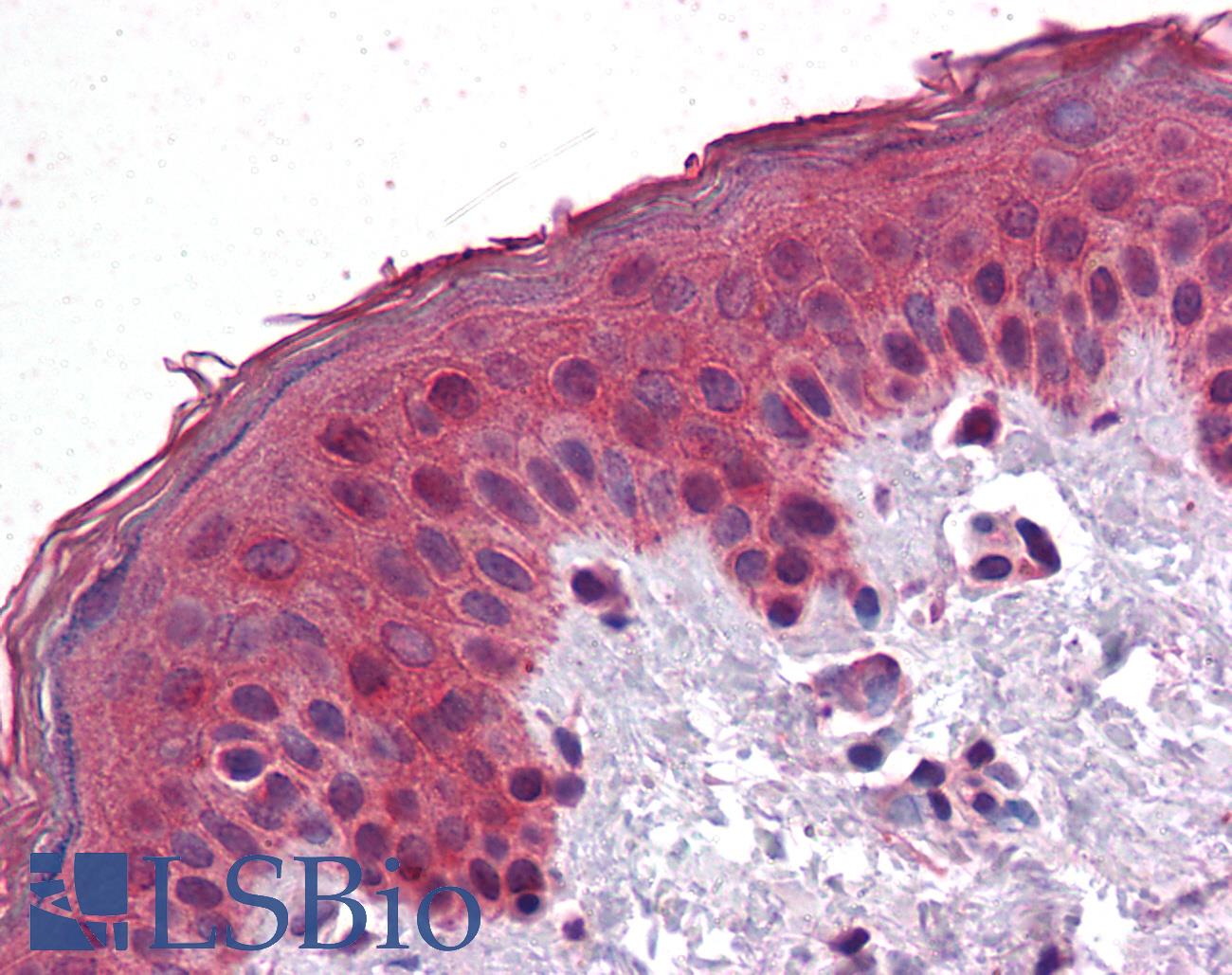 SAR1A / SAR1 Antibody - Anti-SAR1A antibody IHC of human skin. Immunohistochemistry of formalin-fixed, paraffin-embedded tissue after heat-induced antigen retrieval. Antibody concentration 3.75 ug/ml.