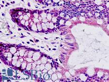 SAR1A / SAR1 Antibody - Anti-SAR1A / SAR1 antibody IHC staining of human small intestine. Immunohistochemistry of formalin-fixed, paraffin-embedded tissue after heat-induced antigen retrieval.