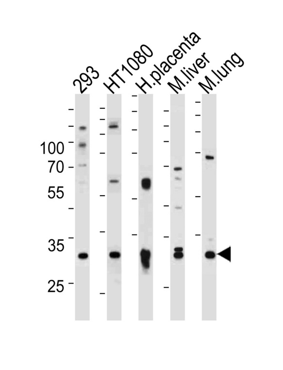 SAR1A / SAR1 Antibody - Western blot of lysates from 293,HT1080 cell line,human placenta,mouse liver and lung tissue (from left to right),using SAR1A Antibody. Antibody was diluted at 1:1000 at each lane. A goat anti-rabbit IgG H&L (HRP) at 1:5000 dilution was used as the secondary antibody.Lysates at 35ug per lane.