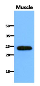 SARA2 / SAR1B Antibody - Western Blot: The extract of Mouse muscle (40 ug) were resolved by SDS-PAGE, transferred to PVDF membrane and probed with anti-human SAR1B antibody (1:1000). Proteins were visualized using a goat anti-mouse secondary antibody.