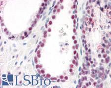 SARNP / Hcc-1 / CIP29 Antibody - Human Prostate: Formalin-Fixed, Paraffin-Embedded (FFPE)
