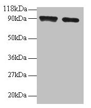 SAT1 / SAT Antibody - Western blot All lanes: Diamine acetyltransferase 1 antibody at 2/ml Lane 1: 293T whole cell lysate Lane 2: EC109 whole cell lysate Secondary Goat polyclonal to rabbit IgG at 1/15000 dilution Predicted band size: 19 kDa Observed band size: 90 kDa