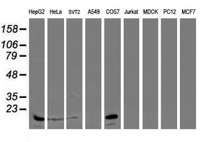 SAT2 Antibody - Western blot of extracts (35 ug) from 9 different cell lines by using g anti-SAT2 monoclonal antibody (HepG2: human; HeLa: human; SVT2: mouse; A549: human; COS7: monkey; Jurkat: human; MDCK: canine; PC12: rat; MCF7: human).