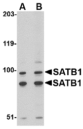 SATB1 Antibody - Western blot of SATB1 in A20 cell lysate with SATB1 antibody at (A) 2 and (B) 4 ug/ml.