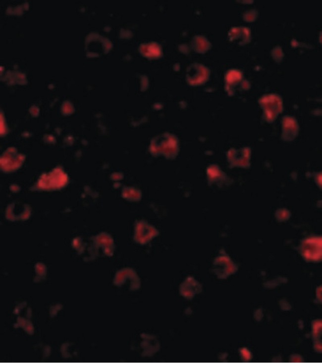 SATB1 Antibody - Immunofluorescence of SATB1 in Human Brain cells with SATB1 antibody at 20 ug/ml.