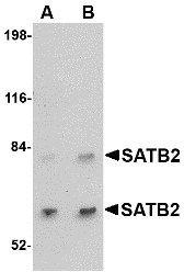 SATB2 Antibody - Western blot of SATB2 in A20 cell lysate with SATB2 antibody at (A) 2 and (B) 4 ug/ml.