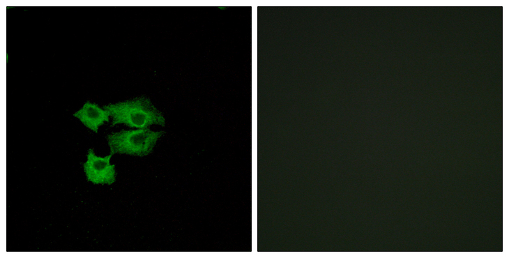 SCA2 / LY6E Antibody - Immunofluorescence analysis of A549 cells, using LY6E Antibody. The picture on the right is blocked with the synthesized peptide.