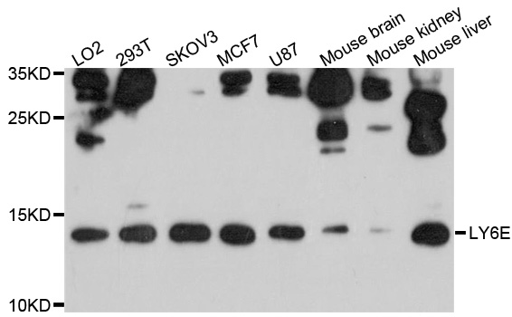 SCA2 / LY6E Antibody - Western blot analysis of extracts of various cell lines, using LY6E antibody at 1:1000 dilution. The secondary antibody used was an HRP Goat Anti-Rabbit IgG (H+L) at 1:10000 dilution. Lysates were loaded 25ug per lane and 3% nonfat dry milk in TBST was used for blocking. An ECL Kit was used for detection and the exposure time was 30s.