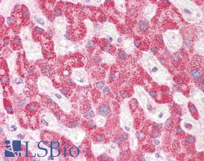 SCA2 / LY6E Antibody - Human Liver: Formalin-Fixed, Paraffin-Embedded (FFPE)