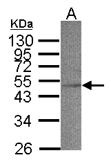 SCAD / ACADS Antibody - Sample(30 g of whole cell lysate). A: MOLT4. 12% SDS PAGE. ACADS antibody diluted at 1:500.