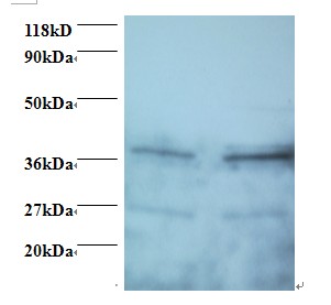 SCAMP3 Antibody - Western blot of Secretory carrier-associated membrane protein 3 antibody at 2 ug/ml. Lane 1: EC109 whole cell lysate. Lane 2: 293T whole cell lysate. Secondary: Goat polyclonal to Rabbit IgG at 1:15000 dilution. Predicted band size: 38 kDa. Observed band size: 38 kDa Additional bands at: 27 kDa. We are unsure as to the identity of this extra band.  This image was taken for the unconjugated form of this product. Other forms have not been tested.