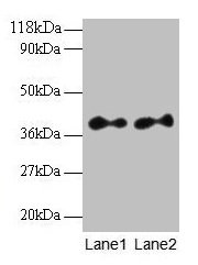 SCAMP3 Antibody - Western blot All lanes: Secretory carrier-associated membrane protein 3 ntibody at 2µg/ml Lane 1: EC109 whole cell lysate Lane 2: 293T whole cell lysate Secondary Goat polyclonal to rabbit IgG at 1/15000 dilution Predicted band size: 39, 36 kDa Observed band size: 39, 27 kDa