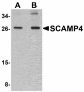 SCAMP4 Antibody - Western blot of SCAMP4 in 3T3 cell lysate with SCAMP4 antibody at (A) 1 and (B) 2 ug/ml.