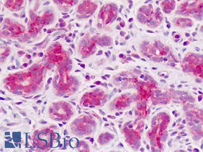 SCAP Antibody - Anti-SCAP antibody IHC staining of human breast. Immunohistochemistry of formalin-fixed, paraffin-embedded tissue after heat-induced antigen retrieval.