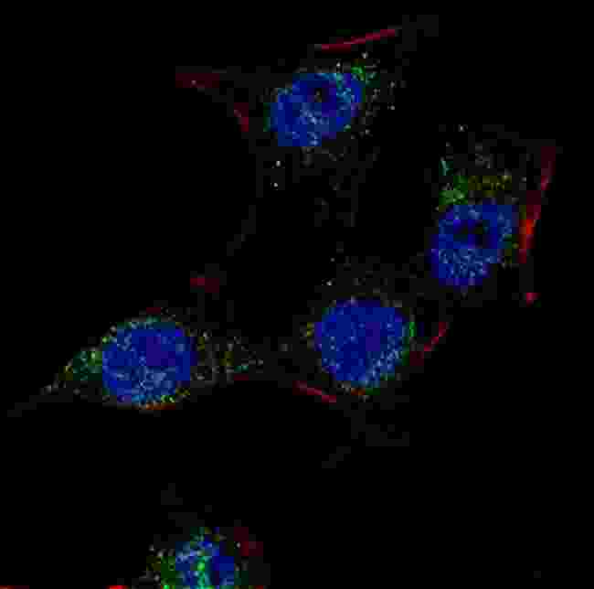 SCAP Antibody - Fluorescent confocal image of HeLa cells stained with SCAP antibody. HeLa cells were fixed with 4% PFA (20 min), permeabilized with Triton X-100 (0.2%, 30 min). Cells were then incubated SCAP primary antibody (1:100, 2 h at room temperature). For secondary antibody, Alexa Fluor 488 conjugated donkey anti-rabbit antibody (green) was used (1:1000, 1h). Nuclei were counterstained with Hoechst 33342 (blue) (10 ug/ml, 5 min).
