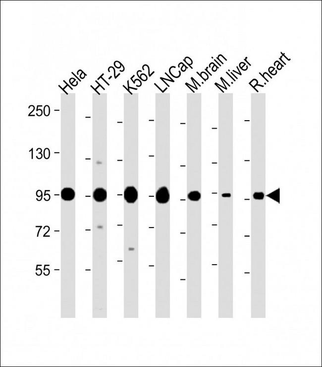 SCAP Antibody - Western blot analysis of Anti-SCAP antibody (LS-B9086, 1:2000 dilution; 20 µg of lysate/protein per lane). Lane 1: HeLa whole cell lysate. Lane 2: HT-29 whole cell lysate. Lane 3: K562 whole cell lysate.  Lane 4: LNCap whole cell lysate.  Lane 5: Mouse brain lysate. Lane 6: Mouse liver lysate. Lane 7: Rat heart lysate. Antibody produced band at ~95 kDa