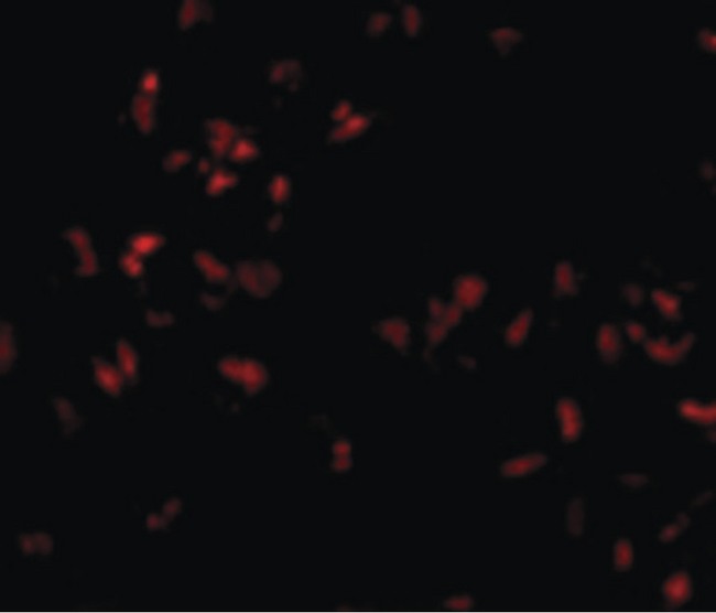 SCARA5 Antibody - Immunofluorescence of SCARA5 in HepG2 cells with SCARA5 antibody at 20 ug/ml.