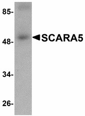 SCARA5 Antibody - Western blot of SCARA5 in human liver tissue lysate with SCARA5 antibody at 1 ug/ml.