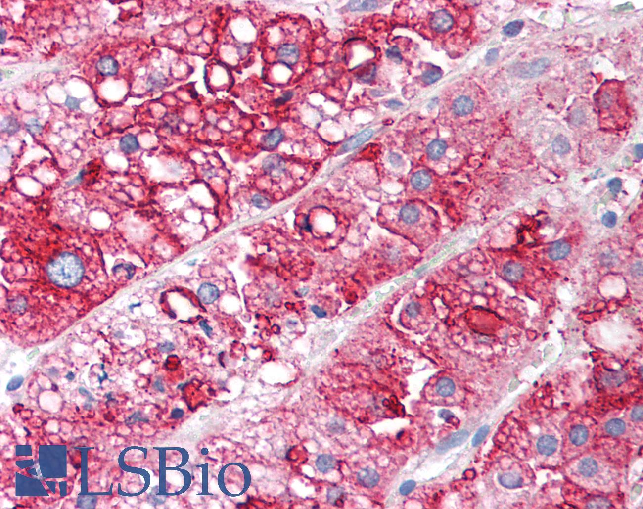 SCARB1 / SR-BI Antibody - Anti-SR-BI antibody IHC of human adrenal cortex. Immunohistochemistry of formalin-fixed, paraffin-embedded tissue after heat-induced antigen retrieval. Antibody dilution 1:400. This image was taken for the unconjugated form of this product. Other forms have not been tested.