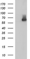 SCARB1 / SR-BI Antibody - HEK293T cells were transfected with the pCMV6-ENTRY control (Left lane) or pCMV6-ENTRY SCARB1 (Right lane) cDNA for 48 hrs and lysed. Equivalent amounts of cell lysates (5 ug per lane) were separated by SDS-PAGE and immunoblotted with anti-SCARB1.
