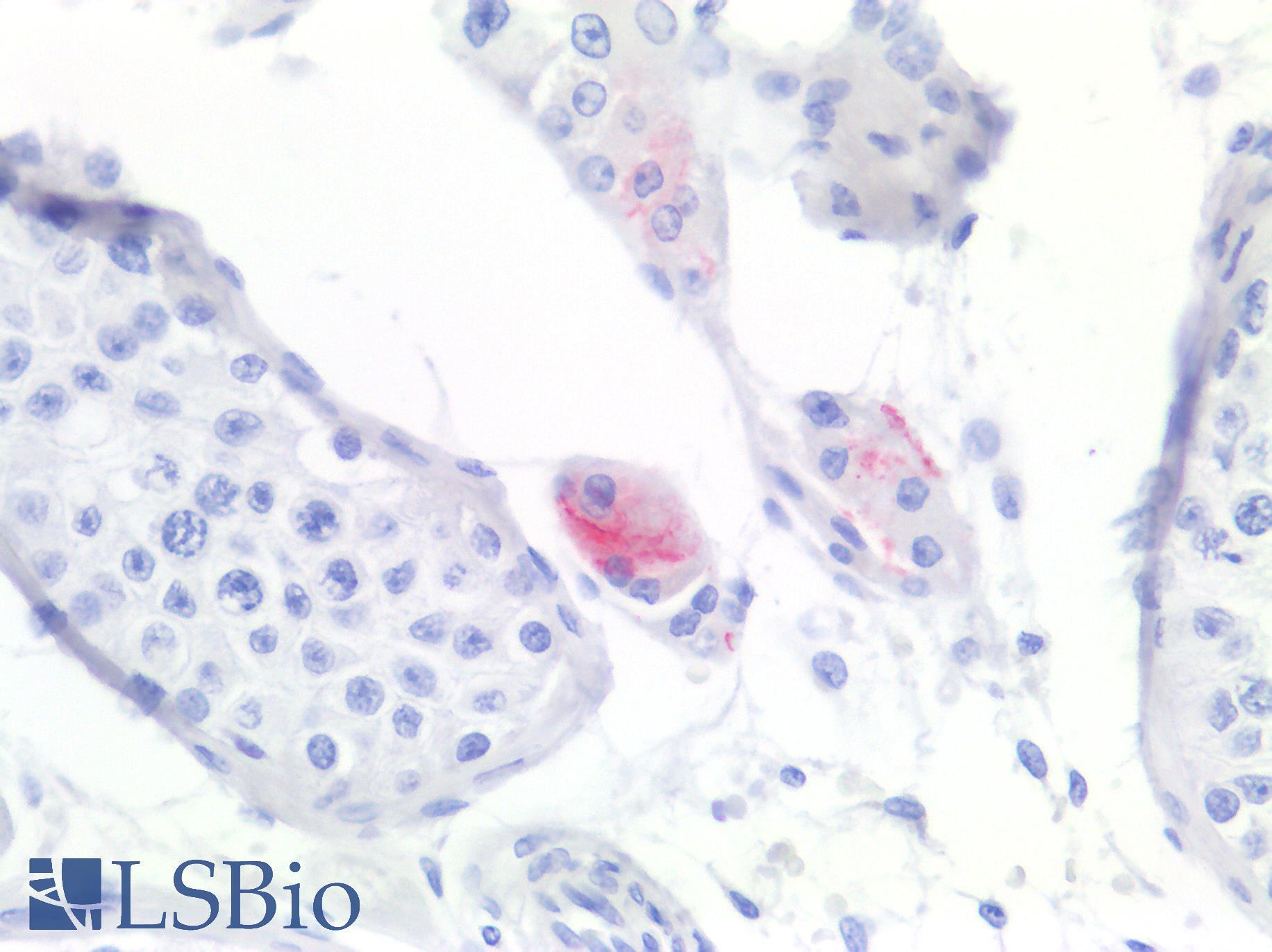 SCARB1 / SR-BI Antibody - Human Testis: Formalin-Fixed, Paraffin-Embedded (FFPE)