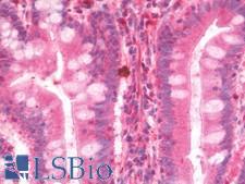 Scavenger Receptor BI + BII Antibody - Anti-Scavenger Receptor BI + BII antibody IHC staining of human small intestine. Immunohistochemistry of formalin-fixed, paraffin-embedded tissue after heat-induced antigen retrieval. Antibody dilution 1:100.