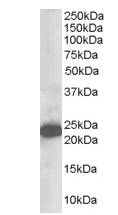 SCG10 / STMN2 Antibody - Western analysis (1 ug/ml) of Human Brain lysate (RIPA buffer, 35 ug total protein per lane). Primary incubated for 1 hour. Detected using chemiluminescence.