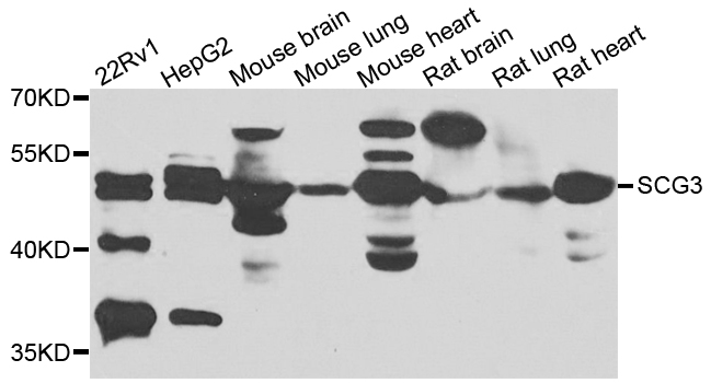 SCG3 / Secretogranin 3 Antibody - Western blot blot of extracts of various cells, using SCG3 antibody.