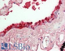 SCGB1A1 / Uteroglobin Antibody - Human Lung, Airway: Formalin-Fixed, Paraffin-Embedded (FFPE)
