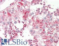 SCGB2A1 / Mammaglobin B Antibody - Anti-Mammaglobin B / SCGB2A1 antibody IHC of human testis. Immunohistochemistry of formalin-fixed, paraffin-embedded tissue after heat-induced antigen retrieval. Antibody dilution 5 ug/ml.