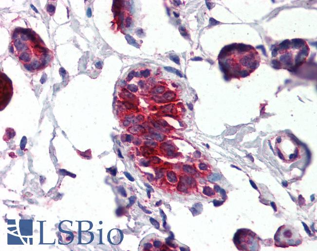 SCGB2A2 / Mammaglobin A Antibody - Anti-SCGB2A2 / Mammaglobin A antibody IHC of human breast. Immunohistochemistry of formalin-fixed, paraffin-embedded tissue after heat-induced antigen retrieval. Antibody concentration 4 ug/ml.